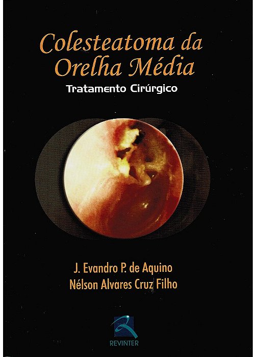 Livro Colesteatoma da Orelha Media - Aquino