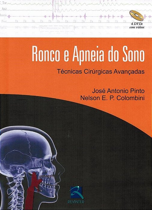 Livro Ronco e Apneia do Sono: Tecnicas Cirurgicas Avancadas - Pinto/colombini