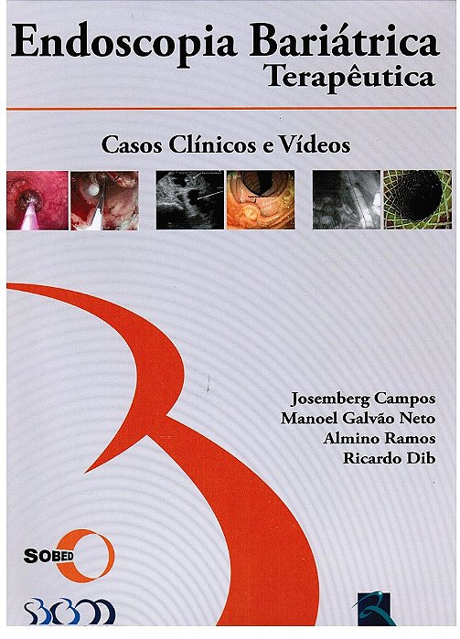Livro Endoscopia Bariátrica Terapêutica