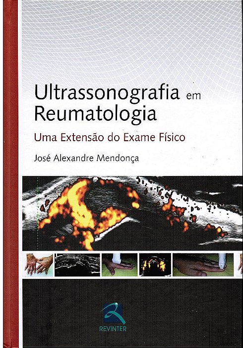 Livro Ultrassonografia Reumatológica  Mendonça