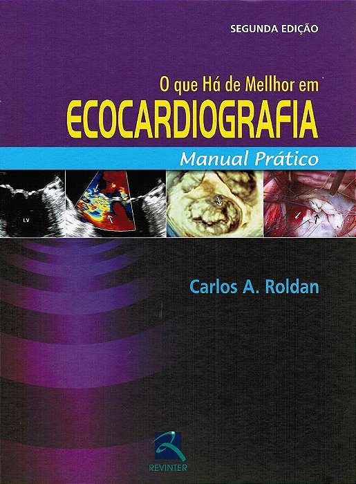 Livro Que Ha de Melhor em Ecocardiograma, O - Roldan