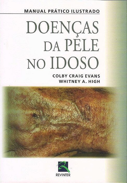 Livro Doencas da Pele No Idoso - Evans/high