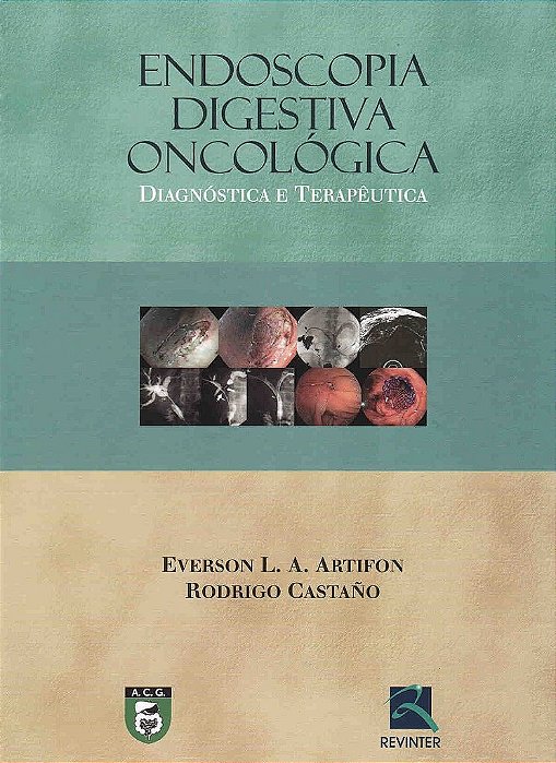 Livro Endoscopia Digestiva Oncológica