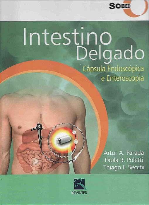 Livro Intestino Delgado: Capsula Endoscopica e Enteroscopia - Parada/poletti/secch