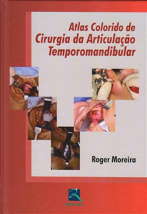 Livro Atlas Colorido de Cirurgia da Articulação Temporomandibular