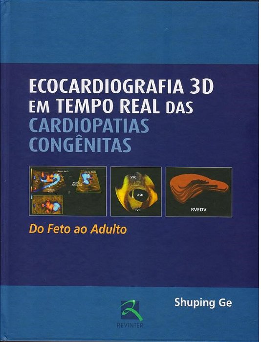 Livro Ecocardiografia 3d em Tempo Real das Cardiopatias Congenitas - do Feto ao A - Ge