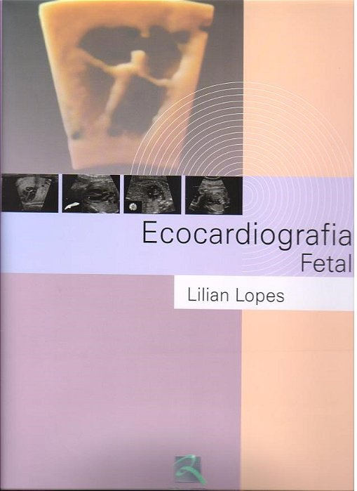 Livro Ecocardiografia Fetal - Lopes - Thieme Revinter