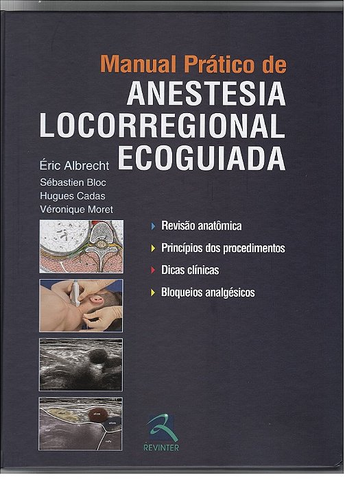 Livro Manual Prático de Anestesia Locorregional Ecoguiada  Albrecht