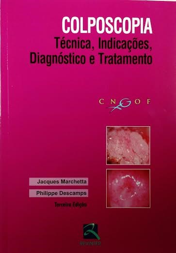 Livro Colposcopia Marchetta