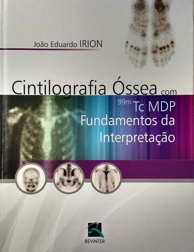 Livro Cintilografia Óssea com 99m TC MDP - Irion