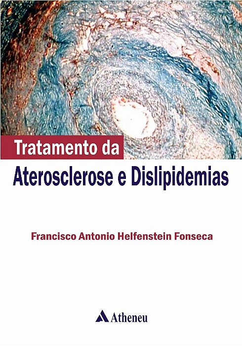 Livro Tratamento  de Ateroesclerose e Dislipidemias - Francisco A. Fonseca