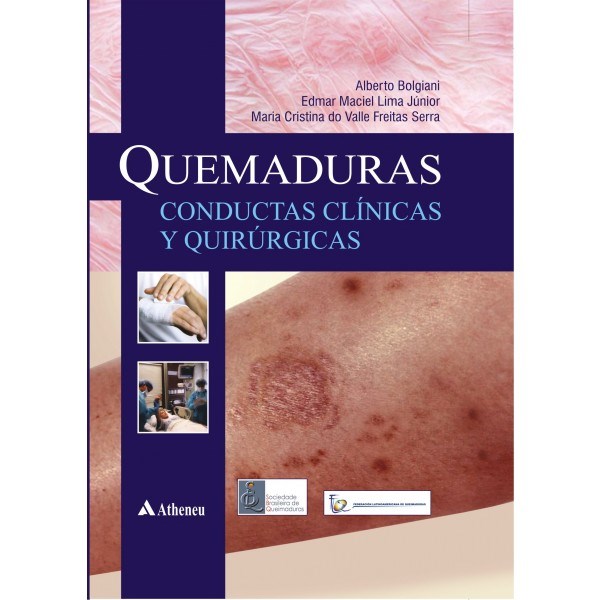 Livro Queimaduras - Conductas Clinicas Y Quirurgicas - Bolgiani/lima Junior