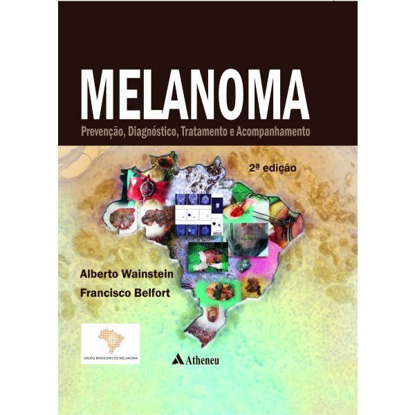 Livro Melanoma - Prevencao, Diagnostico, Tratamento e Acompanhamento - Wainstein/belfort
