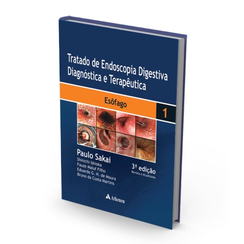 Livro Tratado de Endoscopia Digestiva Diagnóstica e Terapêutica Esôfago