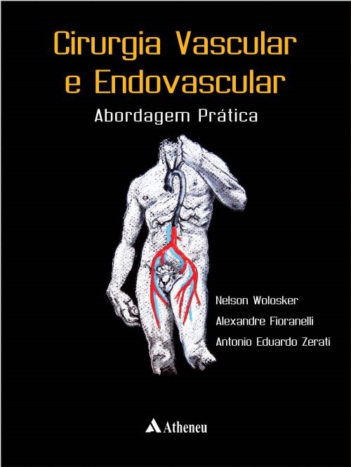 Livro Cirurgia Vascular e Endovascular - Wolosker