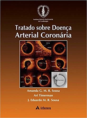 Livro Tratado sobre Doença Arterial Coronária