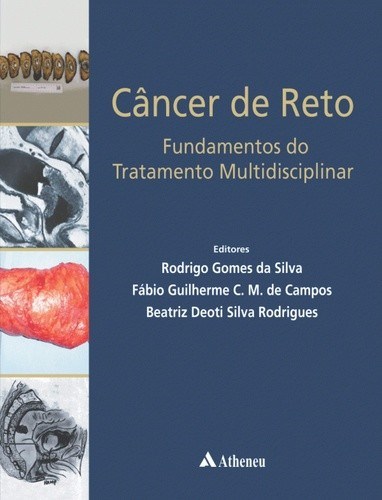 Livro Câncer de Reto