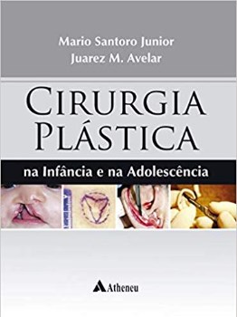 Livro Cirurgia Plastica Na Infancia e Na Adolescencia - Santoro Junior/avela