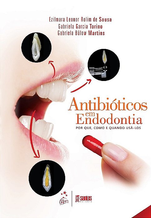 Livro Antibioticos em Endodontia - Porque, Como e Quando Usa-los - Sousa/torino/martins