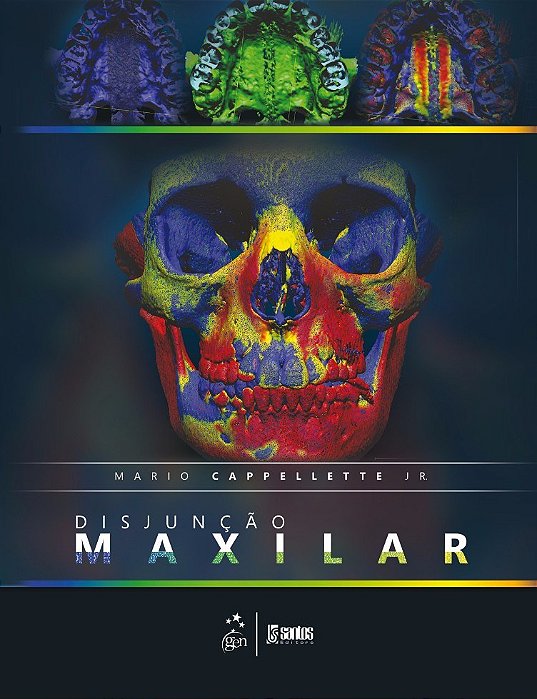 Livro Disjuncao Maxilar - Cappellette Jr.
