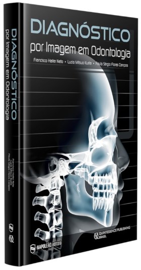 Livro Diagnostico por Imagem em Odontologia - Haiter Neto/kurita/c