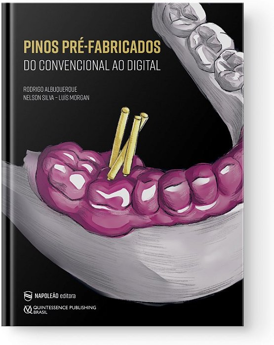 Livro Pinos Pre-fabricados do Convencional ao Digital - Albuquerque/silva/mo