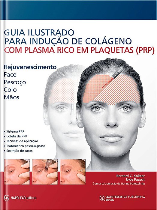 Livro Guia Ilustrado para Indução de Colágeno com Plasma Rico em Plaquetas