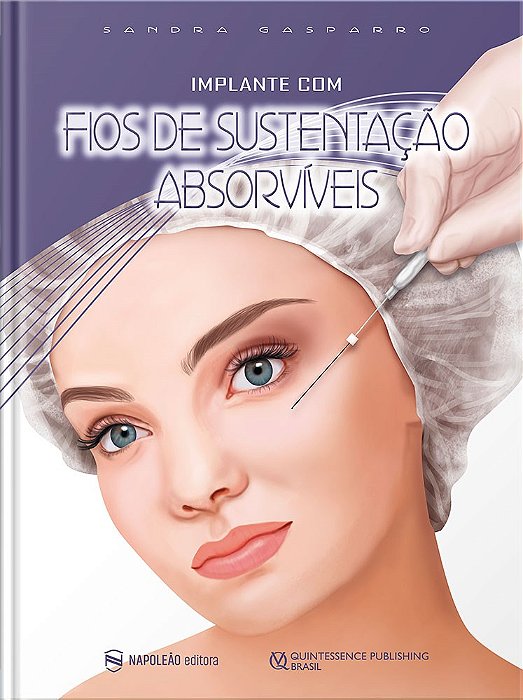 Livro Implante com Fios de Sustentacao Absorviveis - Gasparro
