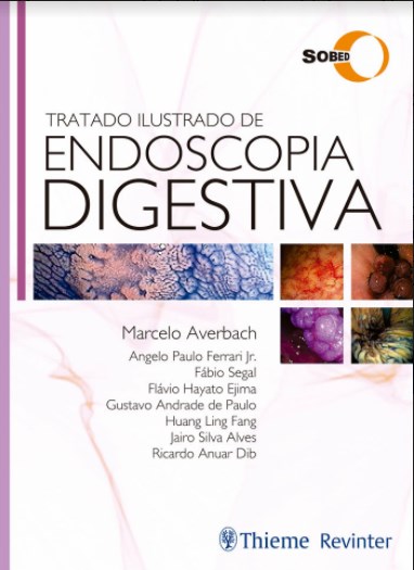 Livro Tratado Ilustrado de Endoscopia Digestiva SOBED