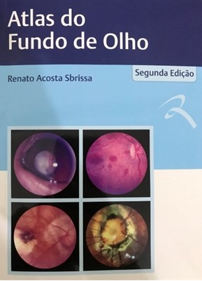 Livro Atlas do Fundo do Olho - Sbrissa