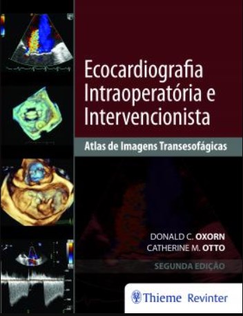 Livro Ecocardiografia Intraoperatoria e Intervencionista Atlas de Imagens Transes - Oxorn / Otto