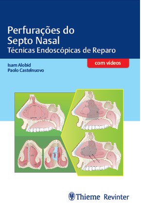 Livro Perfuracoes do Septo Nasal - Tecnicas Endoscopicas de Reparo - Alobid/castelnuovo
