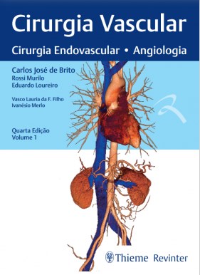 Livro Cirurgia Vascular Cirurgia Endovascular Angiologia 2 Volumes Brito