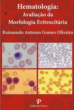 Livro Hematologia Avaliação da Morfologia Eritrocitária: Pranchas