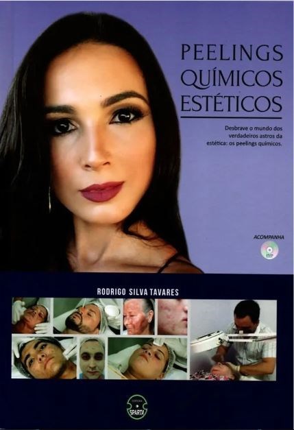 Livro Peelings Químicos Estéticos - Tavares - Sparta