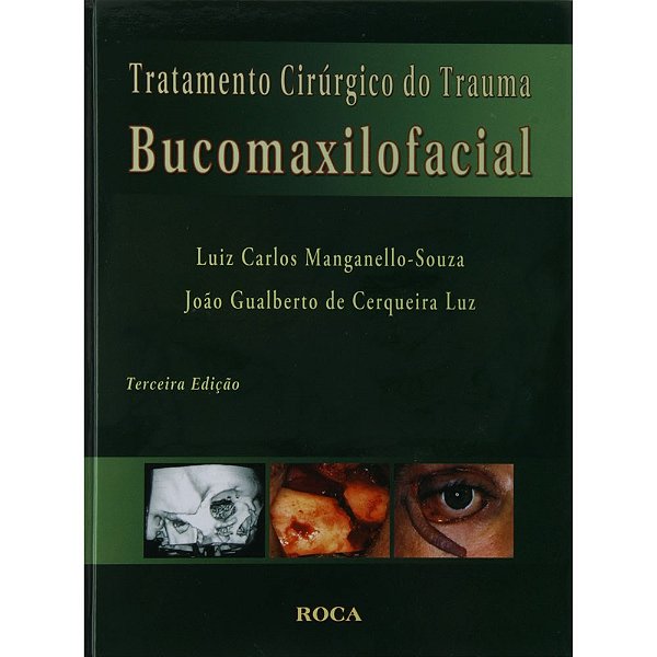 Livro Tratamento Cirurgico do Trauma Bucomaxilofacial - Cerqueira