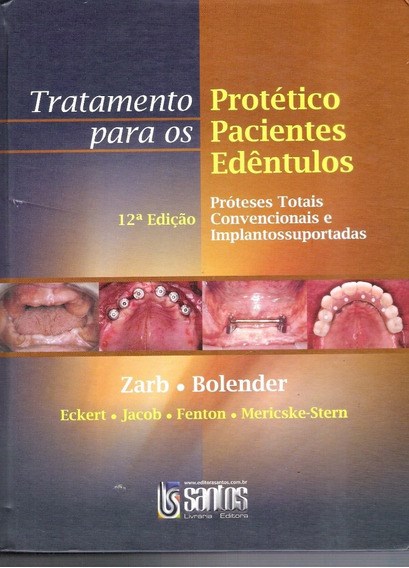 Livro Tratamento Protético para os Pacientes Edentulos - Zarb - Santos