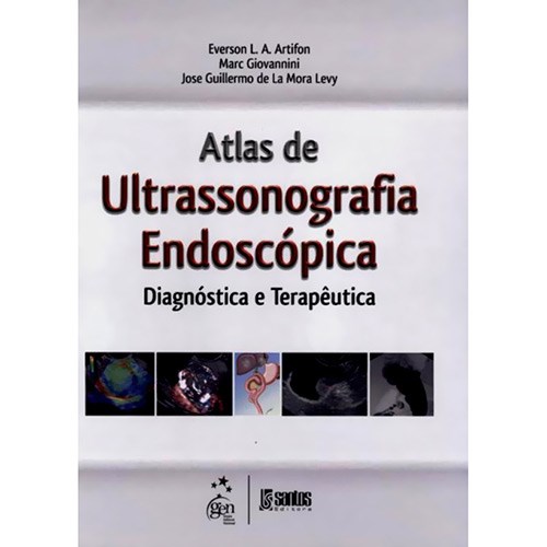 Livro Atlas De Ultrassonografia Endoscópica Diagnóstica E Terapêutica - Artifon