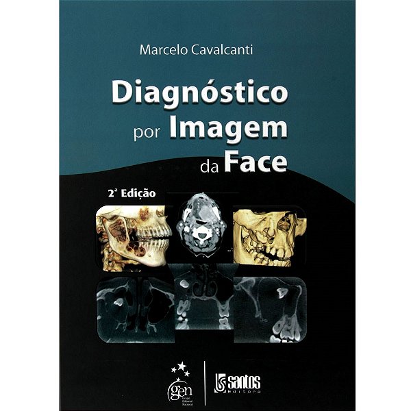 Livro Diagnóstico por Imagem da Face: Cavalcanti