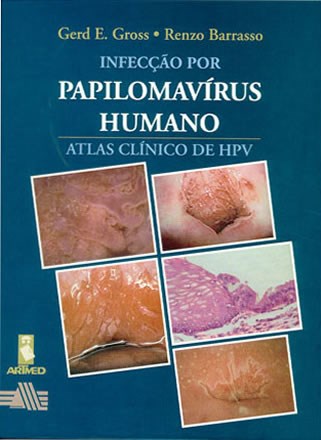 Livro Infeccao por Papilomavirus Humano - Atlas Clinico de Hpv - Gross/barrasso