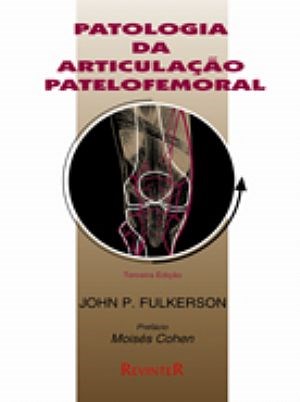 Livro Patologia da Articulacao Patelofemoral - Fulkerson