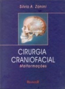 Livro Cirurgia Craniofacial - Malformacoes *** - Zanini