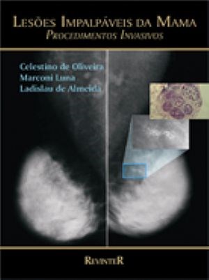 Livro Lesoes Impalpaveis da Mama - Proc. Invasivos - Celestino/luna