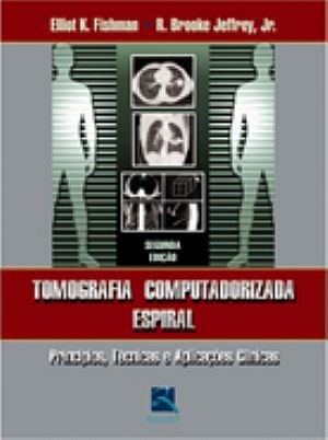 Livro Tomografia Computadorizada Espiral Principios Tecnicas e Aplicacoes Clinica - Fishman