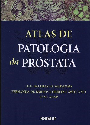 Livro Atlas de Patologia da Próstata - Saldanha