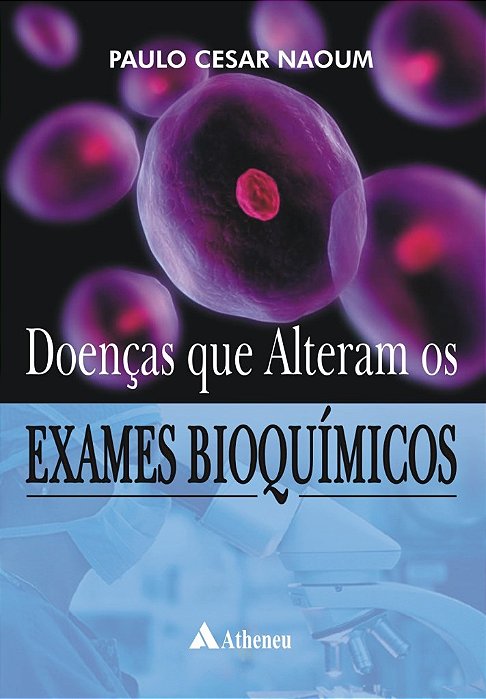 Livro Doenças Que Alteram os Exames Bioquímicos   Naoum