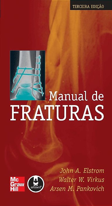 Livro Manual de Fraturas - Elstrom