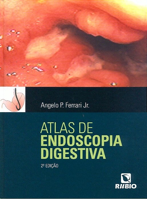 Livro Atlas de Endoscopia Digestiva
