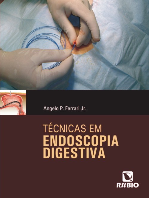 Livro Técnicas em Endoscopia Digestiva - Ferrari - Rúbio