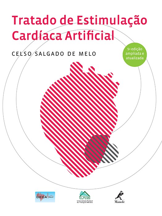 Livro Tratado de Estimulação Cardíaca Artificial